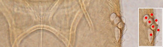 Seven ommatidia. Seven ommatidia.