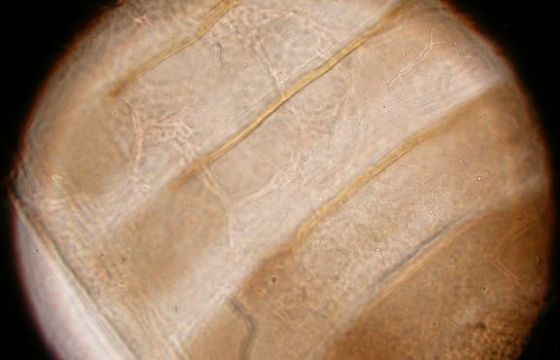 Abdominal areoles. Abdominal areoles.