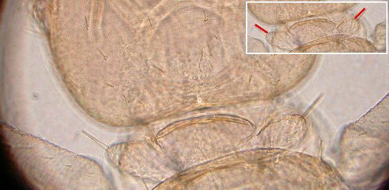 The shoulder bristle of liposcelis decolor. The shoulder bristle of liposcelis decolor.