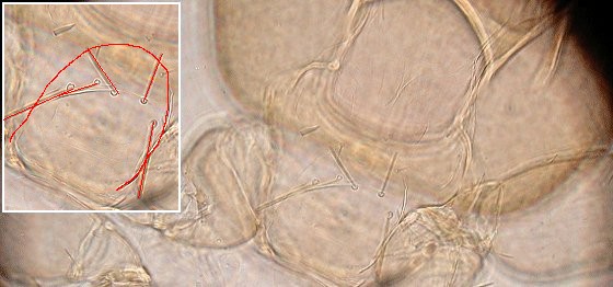 All prosternal bristles anterior to middle of prosternum. All prosternal bristles anterior to middle of prosternum.