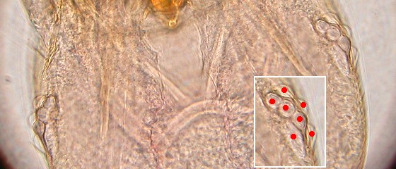 Seven ommatidia of liposcelis decolor. Seven ommatidia of liposcelis decolor.