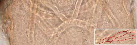 Areoles of vertex. Areoles of vertex.