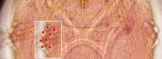 Eight ommatidia of Liposcelis fusciceps. Eight ommatidia of Liposcelis fusciceps.