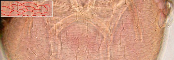 Areoles of vertex of Liposcelis fusciceps. Areoles of vertex of Liposcelis fusciceps.